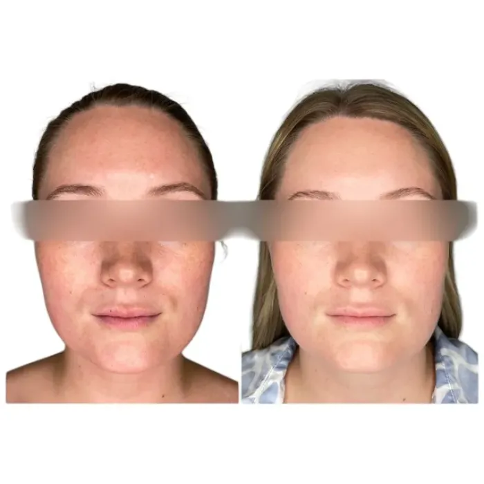 Сыворотка для ультра-сияния и лечения гиперпигментации Alphascience Alpha Bright Serum