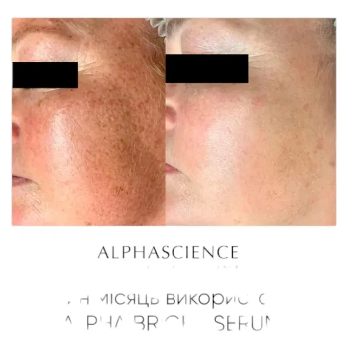 Сыворотка для ультра-сияния и лечения гиперпигментации Alphascience Alpha Bright Serum