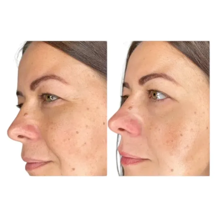 Реструктуризант для глаз комплексный Alphascience Eye Matrix