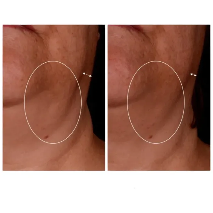 Моделирующий крем для лица, шеи и декольте Alphascience Ultra Firm