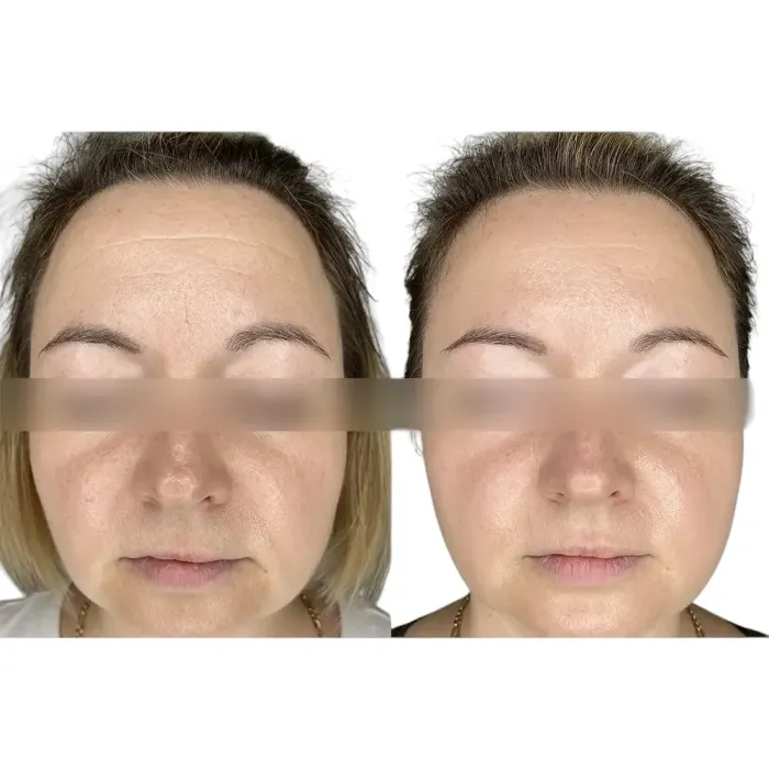 Крем антивозрастной для лица, шеи и декольте Alphascience Ultra Deep