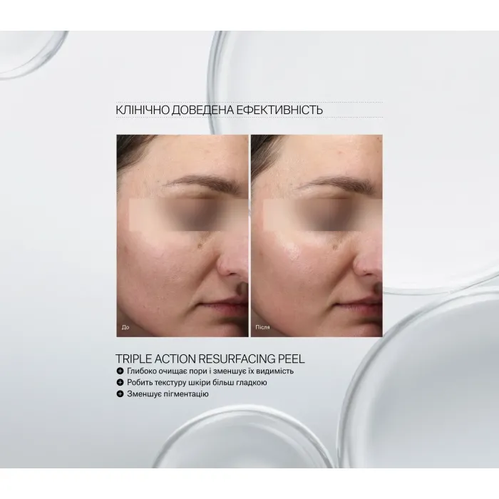 Пілінг потрійної дії Instytutum Triple Action Resurfacing Peel Next-Gen