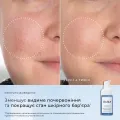 Пептидная сыворотка с ниацинамидом от высыпаний и сужения пор Medik8 Niacinamide Peptides