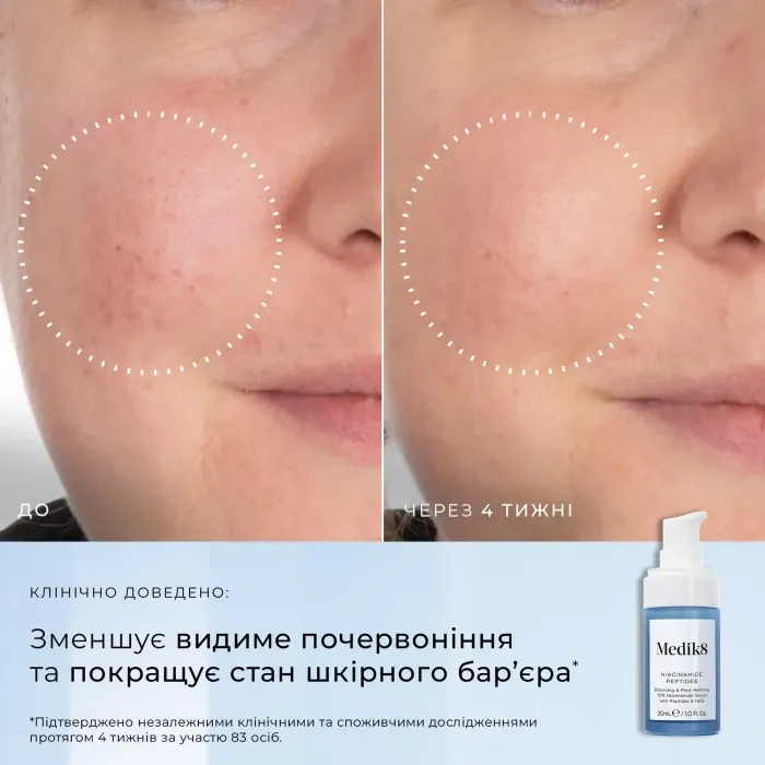 Пептидная сыворотка с ниацинамидом от высыпаний и сужения пор Medik8 Niacinamide Peptides