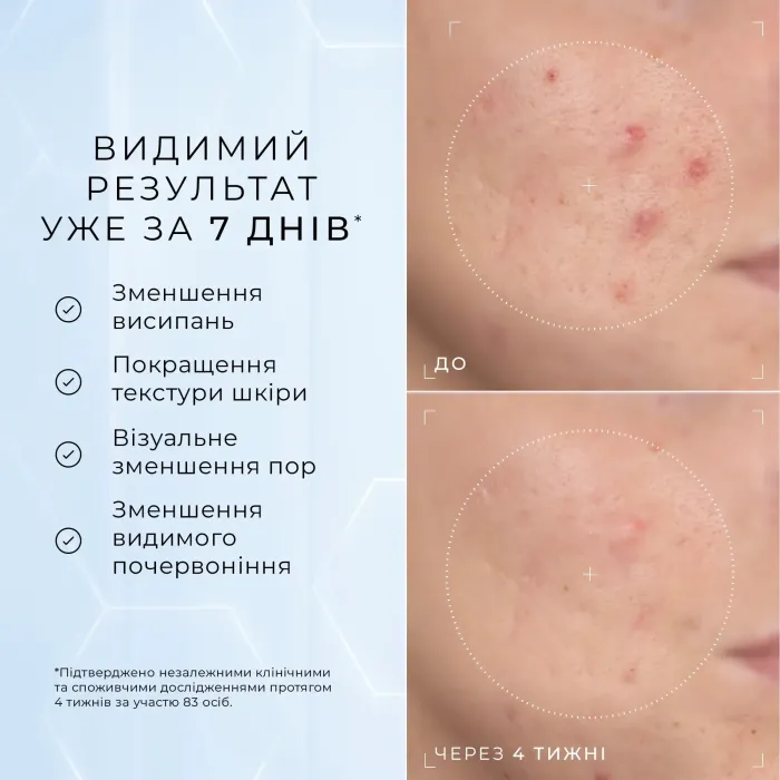 Пептидная сыворотка с ниацинамидом от высыпаний и сужения пор Medik8 Niacinamide Peptides